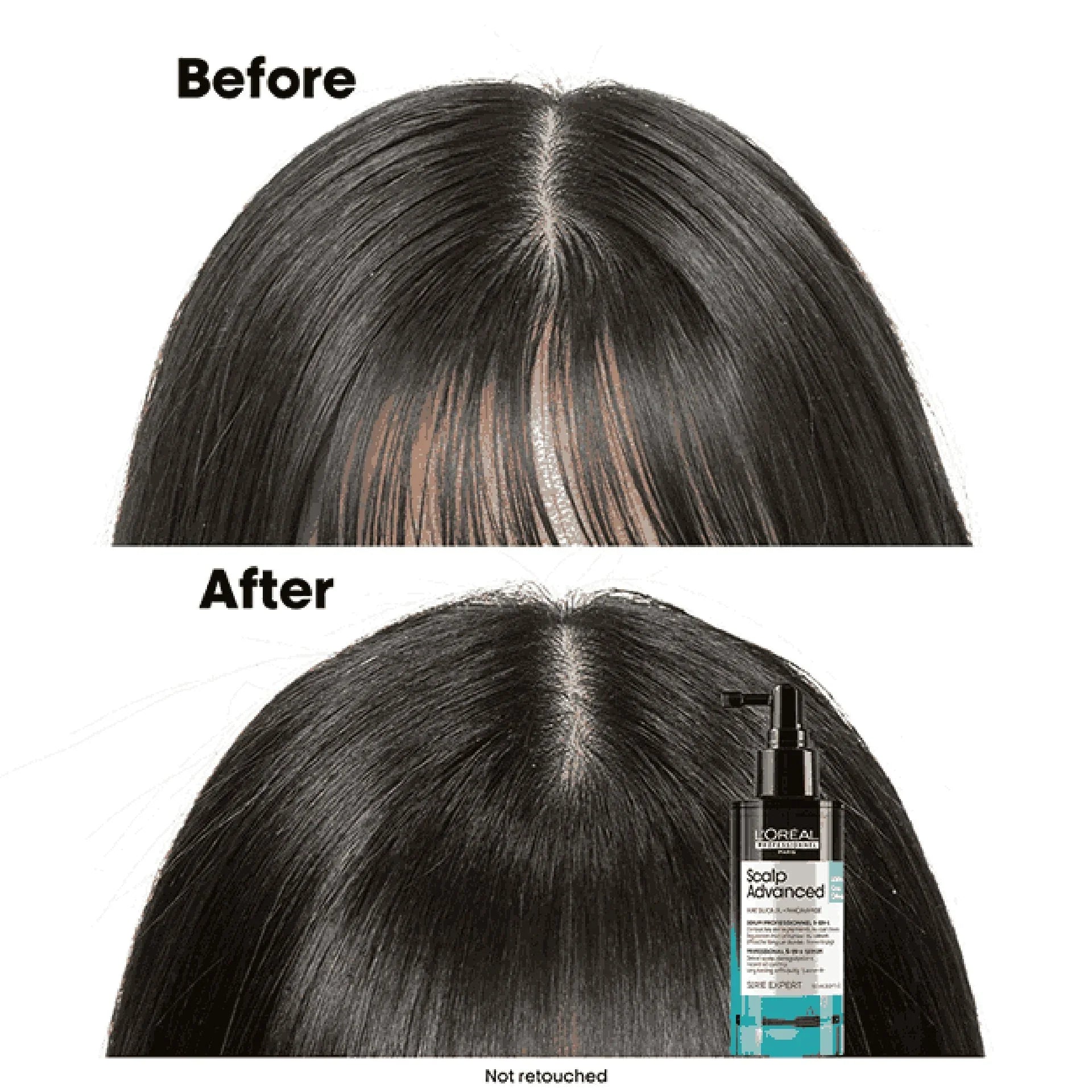 L'Oreal Professionnel Serie Expert Scalp Advanced Professional 5-in-1 Serum 90ml