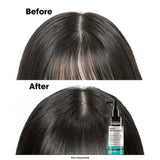 L'Oreal Professionnel Serie Expert Scalp Advanced Professional 5-in-1 Serum 90ml